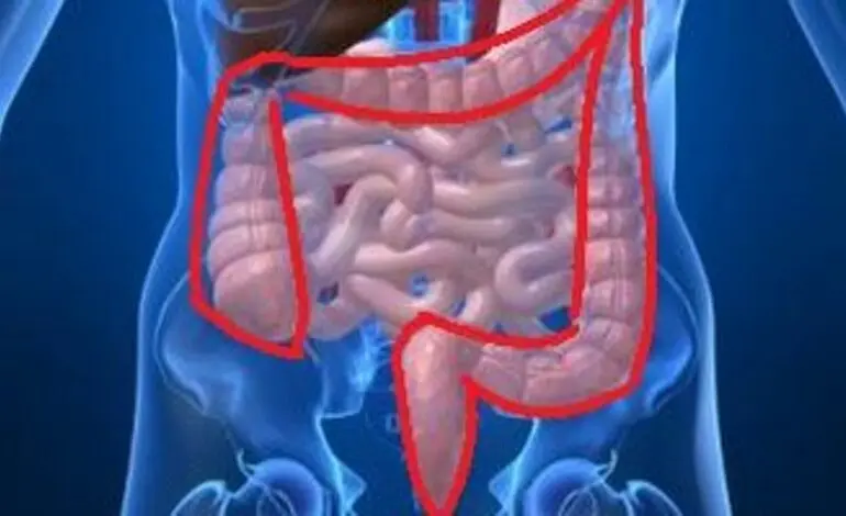 Understanding Colorectal Cancer: Symptoms and Advances