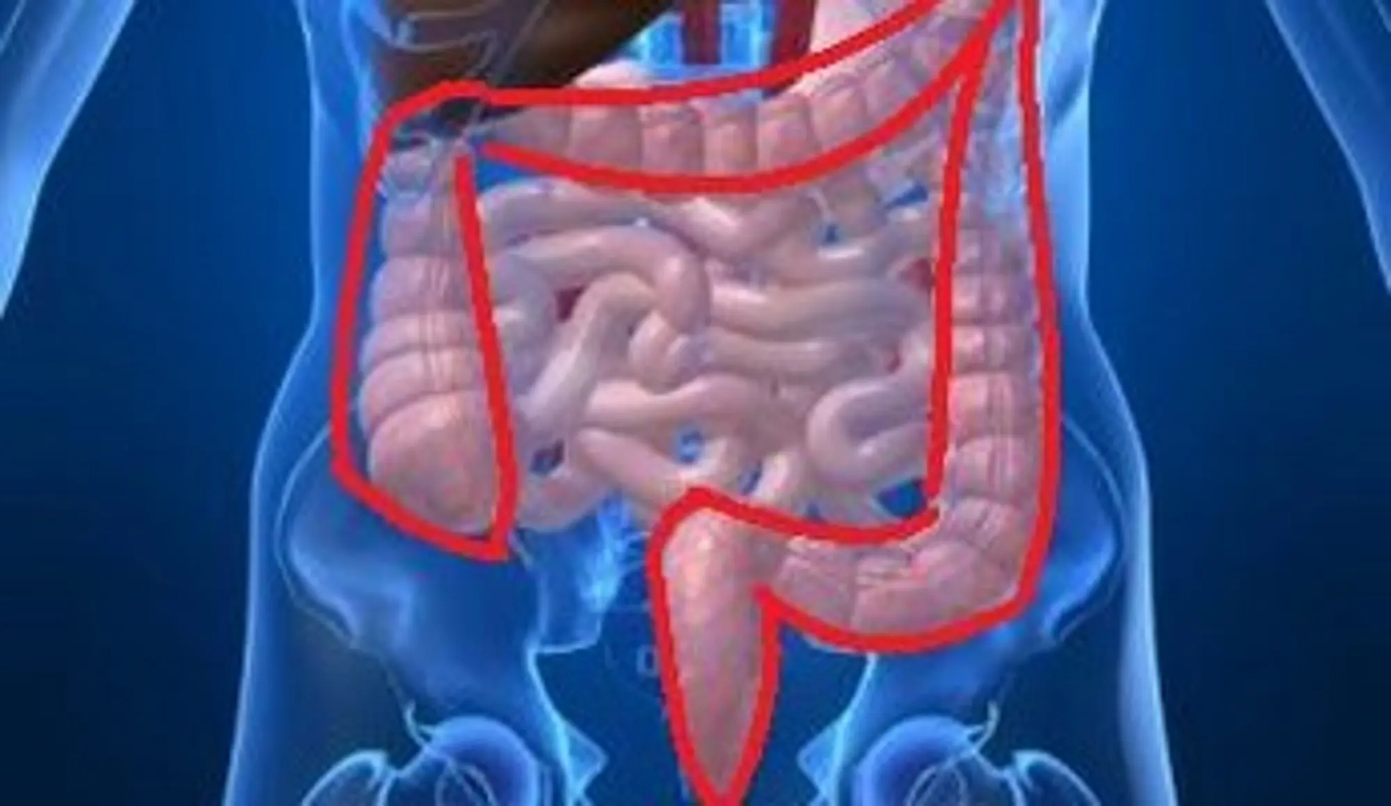 Understanding Colorectal Cancer: Symptoms and Advances