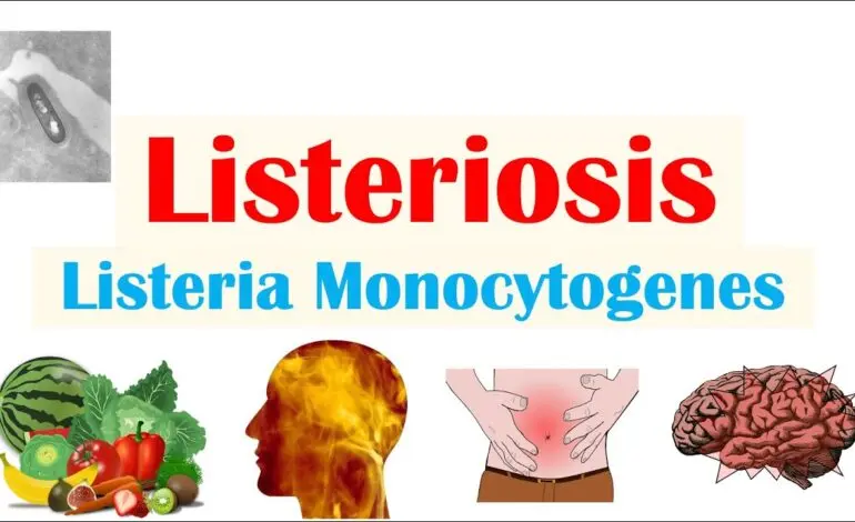 Understanding Listeria: Health Risks and Prevention