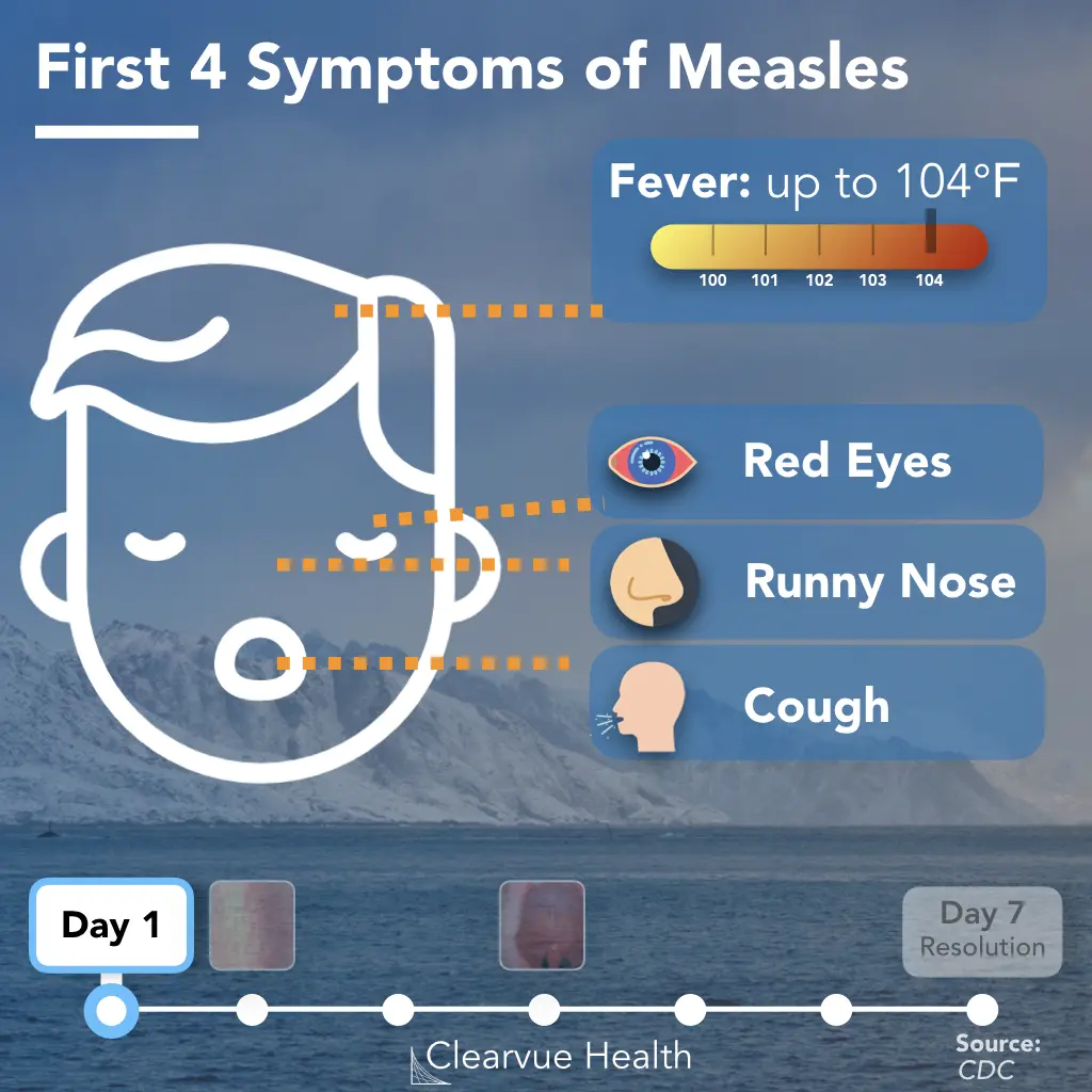 Understanding Measles Symptoms: What You Need to Know