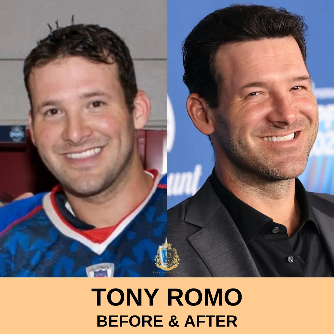 Tony Romo: A Legacy in Football and Broadcasting