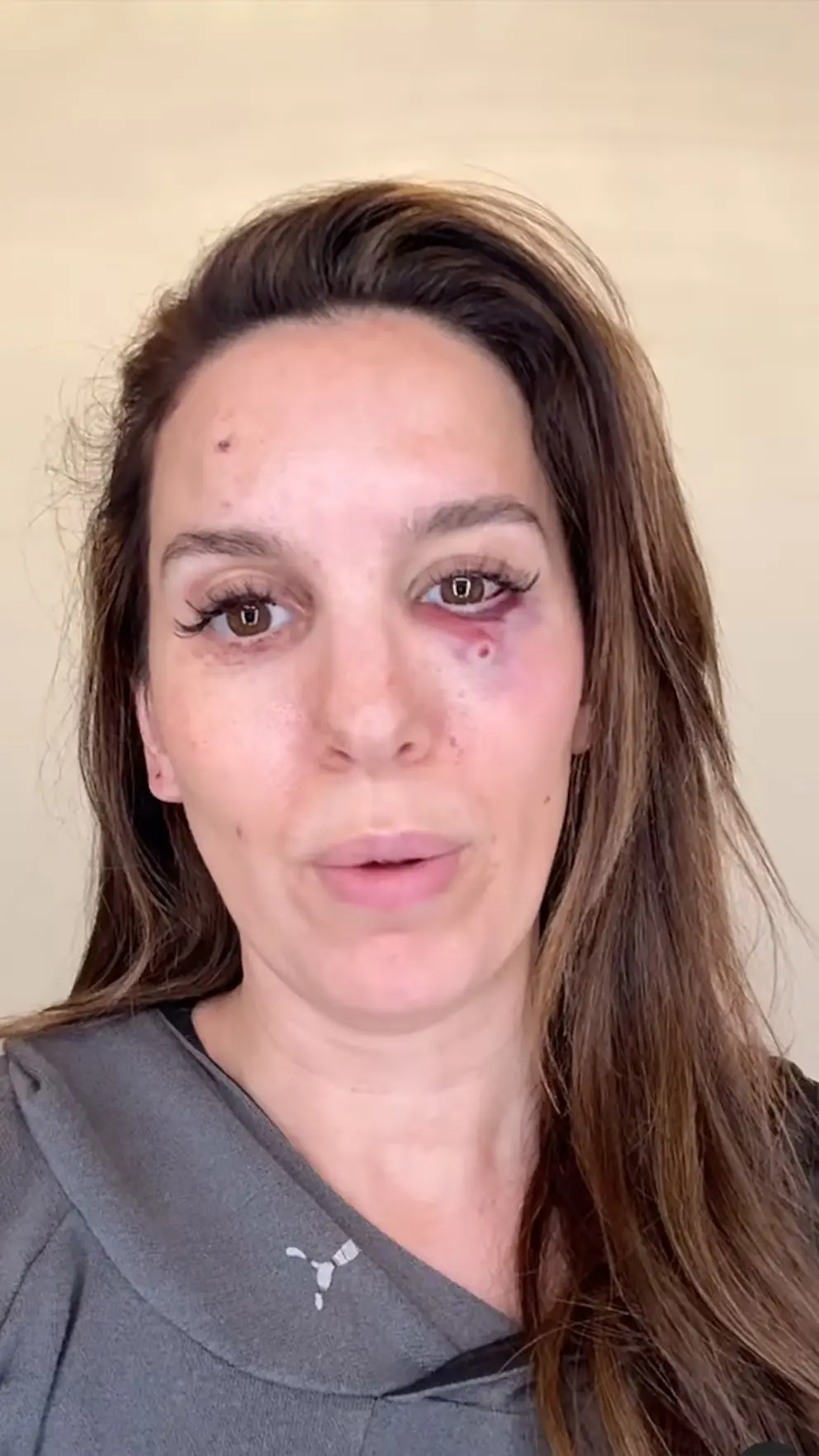 The Rise and Impact of Christy Carlson Romano