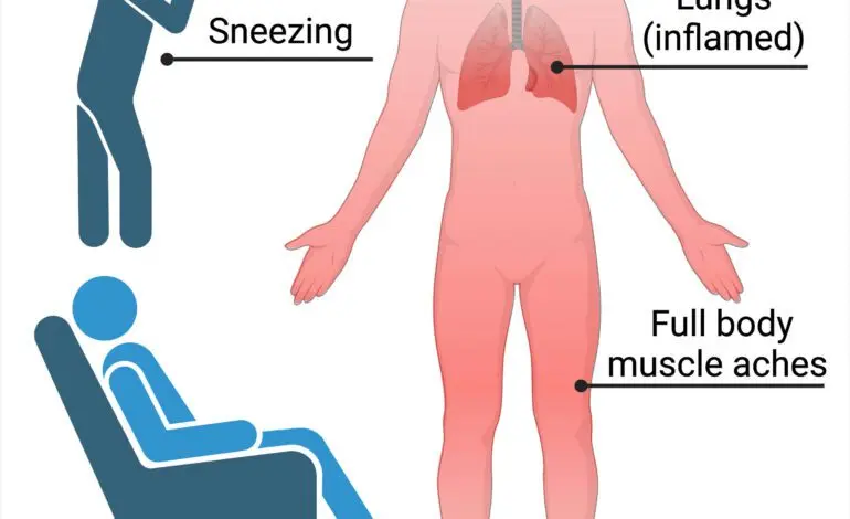 Understanding Flu Symptoms and Their Importance