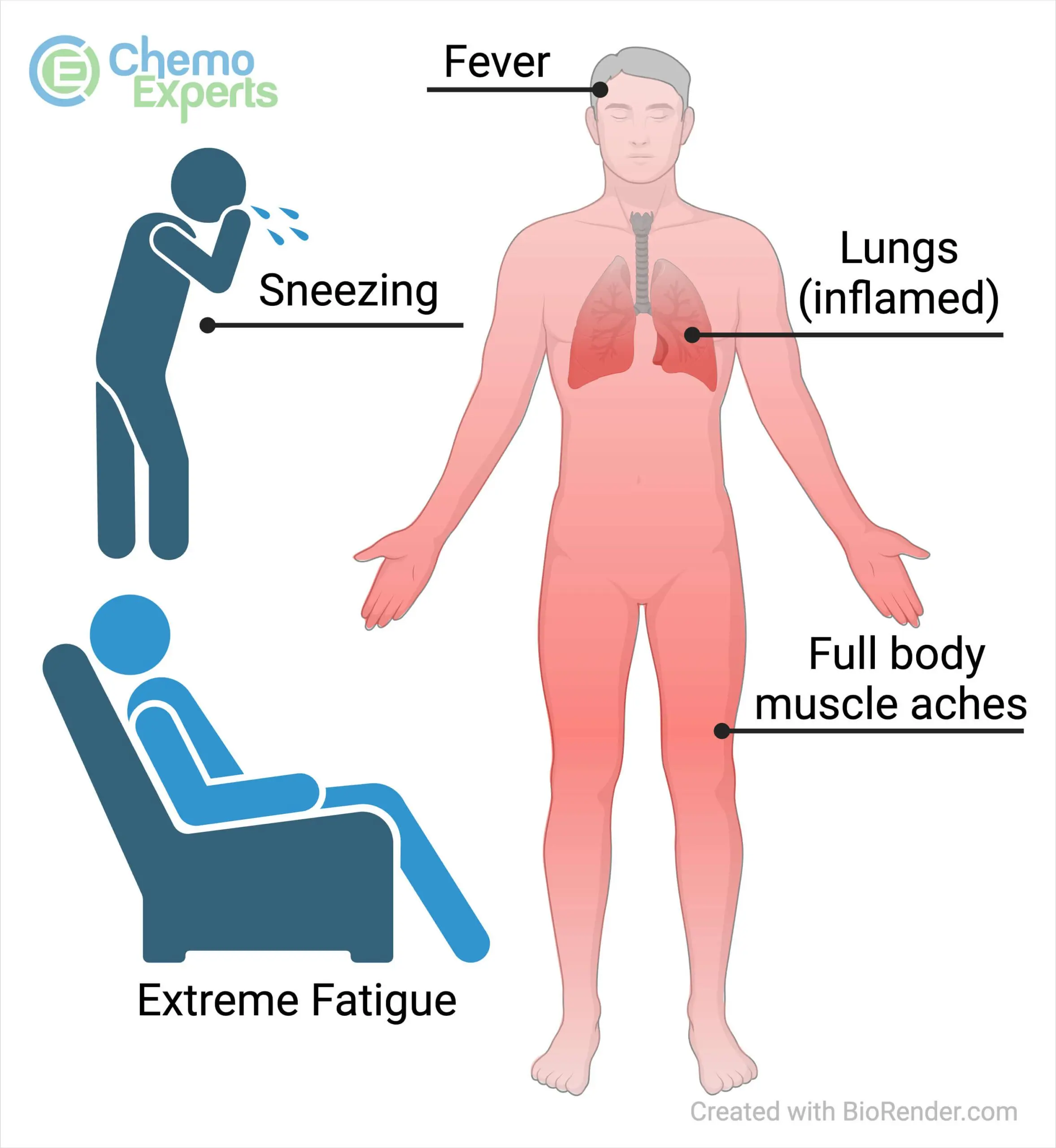 Understanding Flu Symptoms and Their Importance