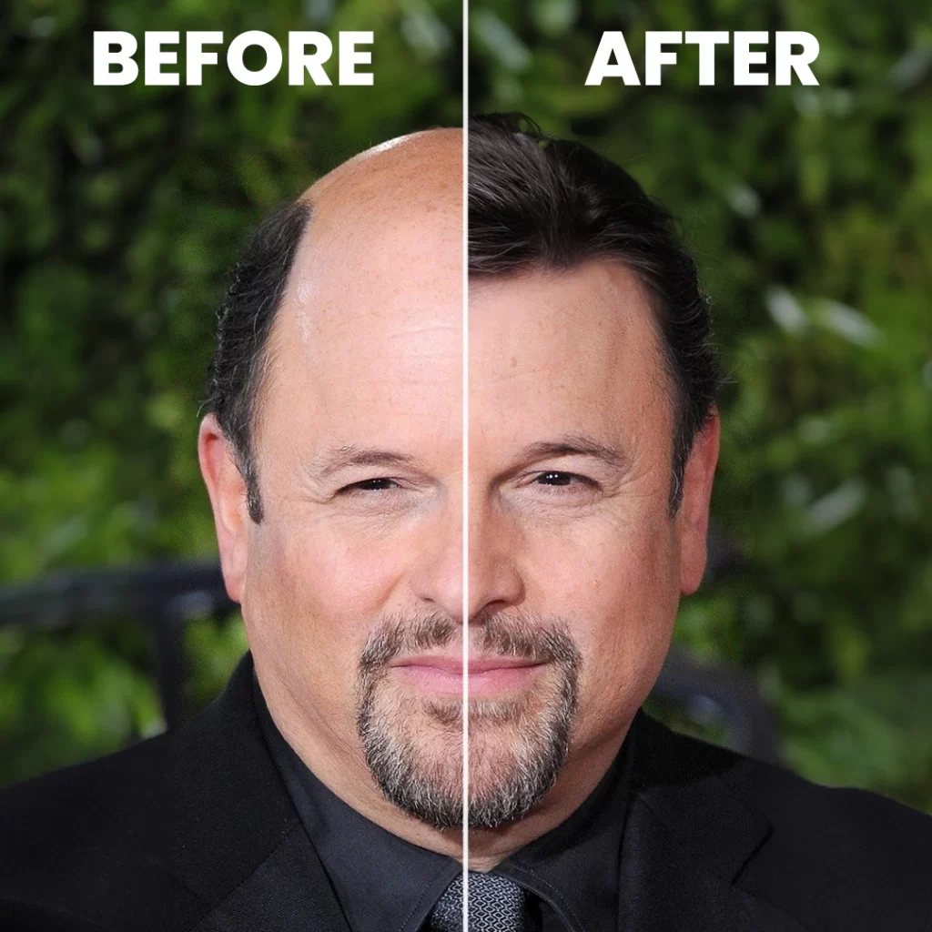 The Journey of Jason Alexander: From Sitcom to Stage