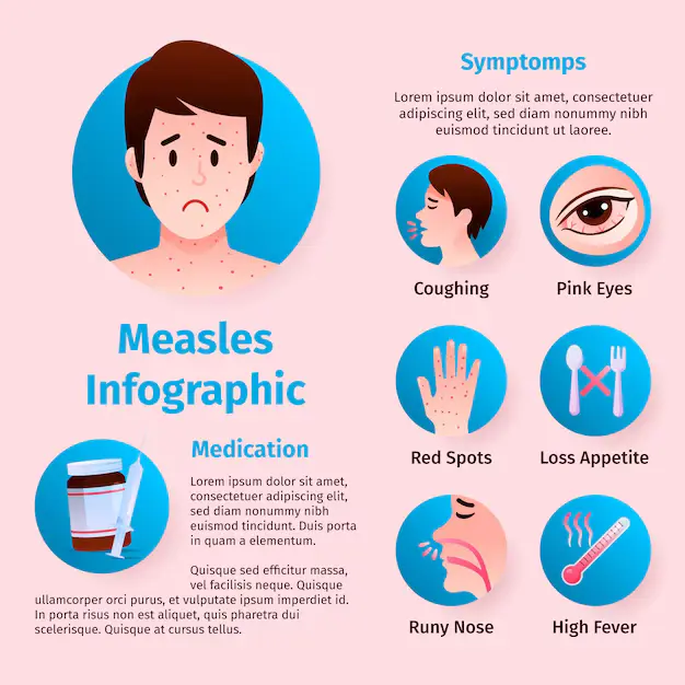 Understanding Measles Symptoms and Their Importance